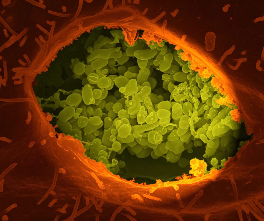 Eine vergrößerte Ansicht einer Ansammlung von Viren in einer Zelle